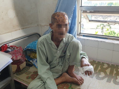 Nghi án ông lão 74 tuổi bị con || cháu rạch nát đầu vì tranh giành đất đai Nghi án ông lão 74 tuổi bị con || cháu rạch nát đầu vì tranh giành đất đai